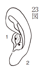 円形脱毛症（第23図）