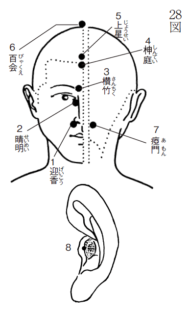 鼻づまり、蓄膿症（第28図）